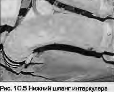 5. Ослабьте хомут и отсоедините нижний шланг от…
