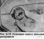 Открыть статью Сальник распределительного вала — замена