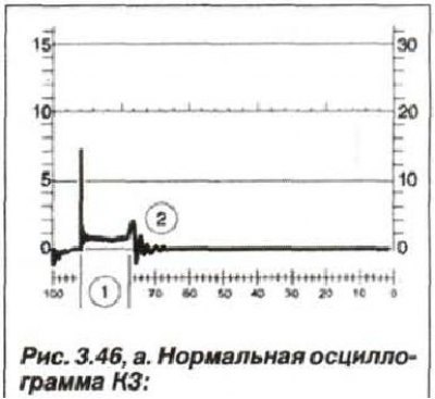 1 - нормальная продолжительность искрового…