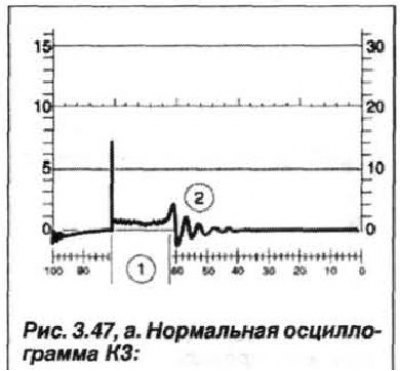 1 - нормальная продолжительность искрового…