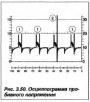 Дефект системы впрыска топлива