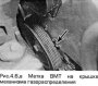 Открыть статью Верхняя мертвая тонка цилиндра №1