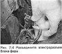 Открыть статью Снятие и установка блоков наружных ламп