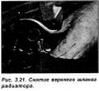 Открыть статью Радиатор и расширительный бачок — снятие и установка