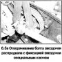 Натяжитель и звездочки — снятие и установка