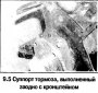 Суппорт переднего тормоза — снятие, разборка и установка