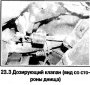 Дозирующий клапан — снятие и установка