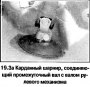 Промежуточный вал рулевой колонки — снятие и установка