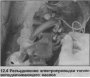Открыть статью Топливоподкачивающий насос — снятие и установка