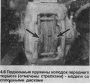 Открыть статью Колодки передних тормозов — осмотр, снятие и установка