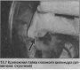 Открыть статью Главный цилиндр — снятие и установка