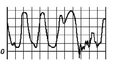Подогреваемый λ-зонд (кислородный датчик)