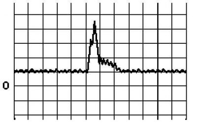 Измеритель объемного расхода потока воздуха (VAF)