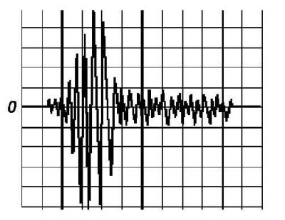 Датчик детонации (KS)