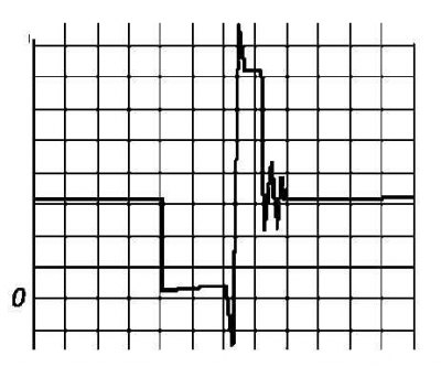 Первичная обмотка катушки зажигания