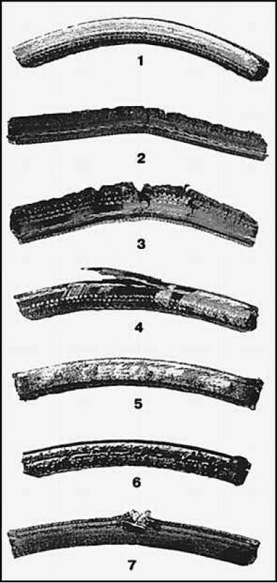 1. Износ боковой поверхности; 2. Сильное…