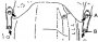 Открыть статью Стабилизатор поперечной устойчивости — снятие